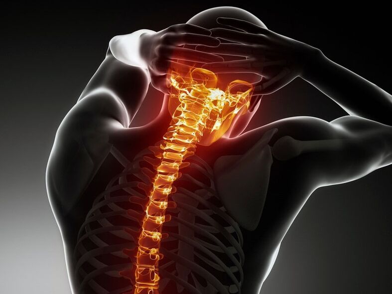 Síntomas de la osteocondrosis