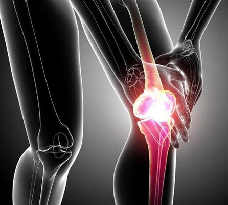 daño a la articulación de la rodilla con artritis y artrosis