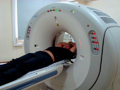 Diagnóstico de resonancia magnética para el dolor de espalda. 