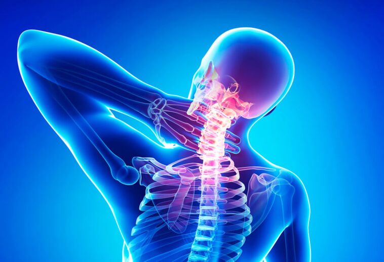 Osteocondrosis de la columna cervical