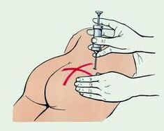 inyección para el tratamiento de la osteocondrosis
