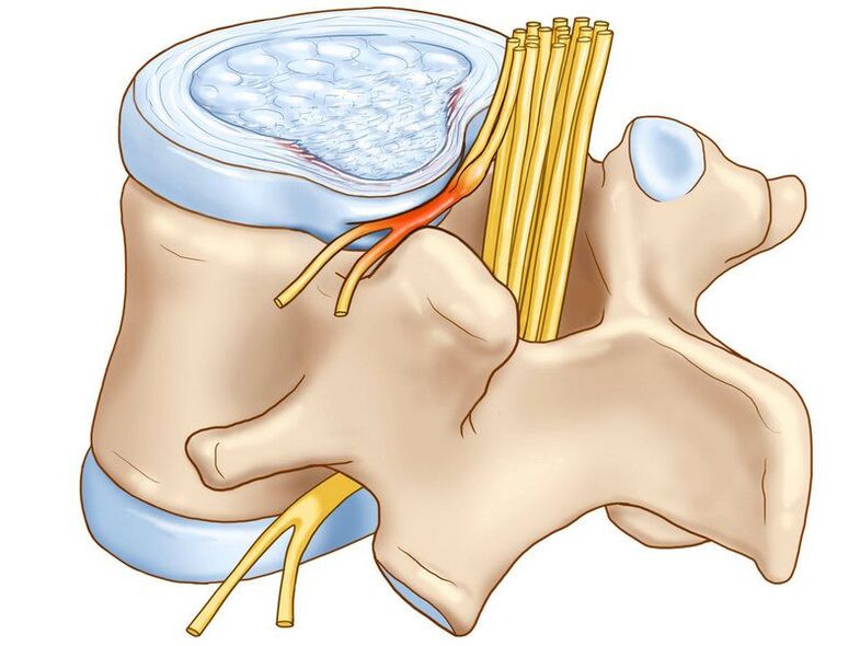La columna vertebral es otra causa de posible dolor.